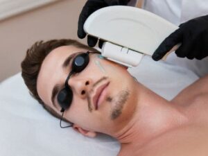 DEPILACIÓN LASER (HOMBRE) 8 SESIONES